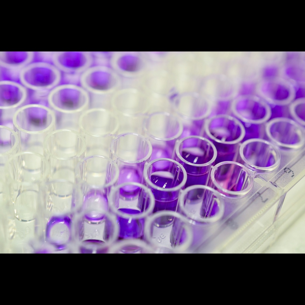 AGEs elisa kit :: Rat Advanced glycation end products  AGEs  ELISA Kit size: 96size:Stripsize:Wells